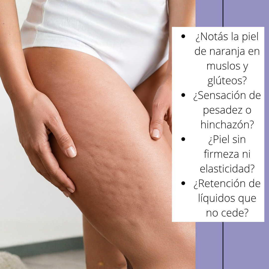 Crema Anticelulitis